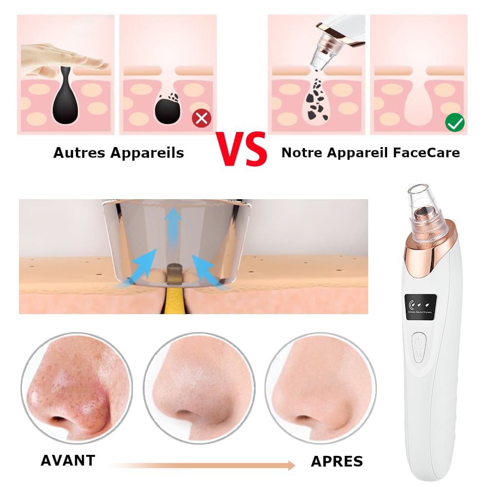 Aspirateur de points noirs, nettoyeur de pores pour visage, élimination des impuretés, appareil facial anti-acné, soin peau en profondeur – Image 9