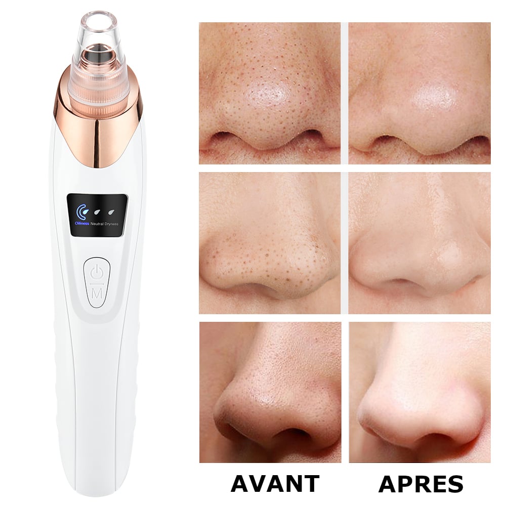 Aspirateur de points noirs, nettoyeur de pores pour visage, élimination des impuretés, appareil facial anti-acné, soin peau en profondeur – Image 7